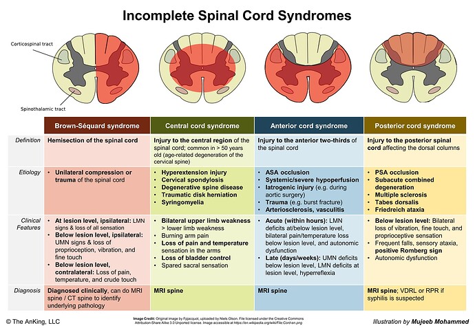 spinal cord syndromes