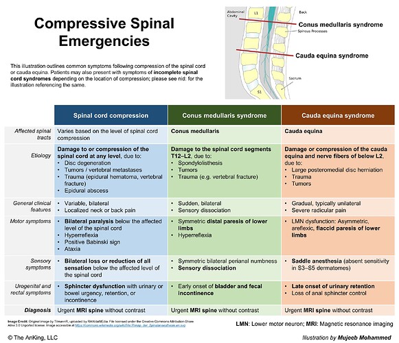 compressive spinal