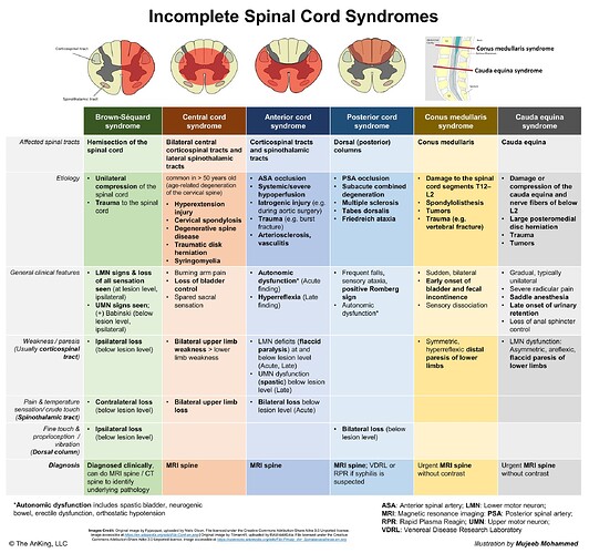 spinal cord syndromes