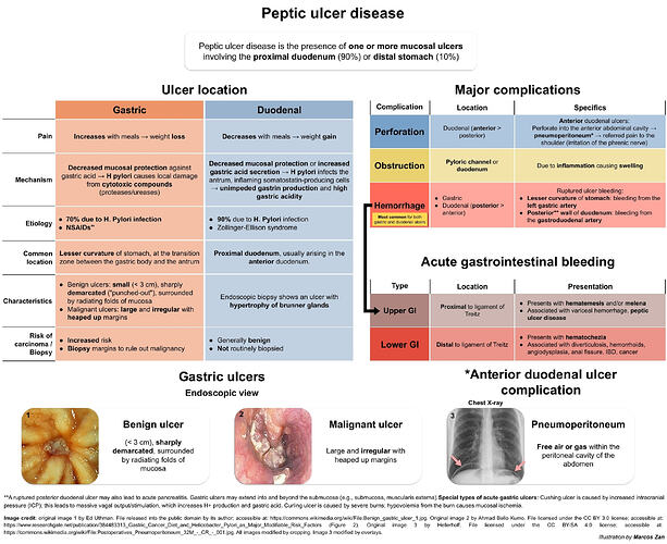Peptic ulcer disease copy
