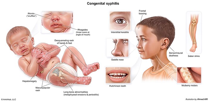 Congenital syphilis
