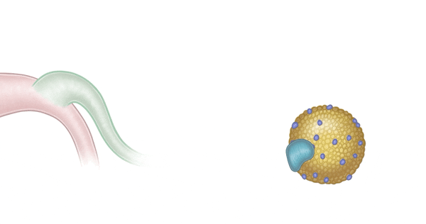 3 - Chylomicron formation & triglyceride delivery_comp