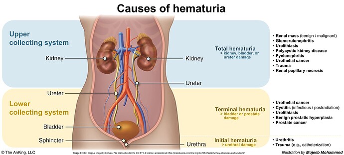 Causes of hematuria