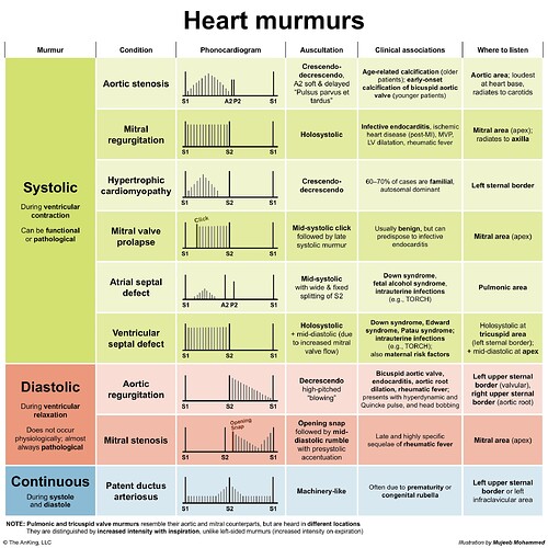 The image is a chart detailing heart murmurs, including types, phonocardiograms, auscultation characteristics, clinical associations, and auscultation locations. (Captioned by AI)