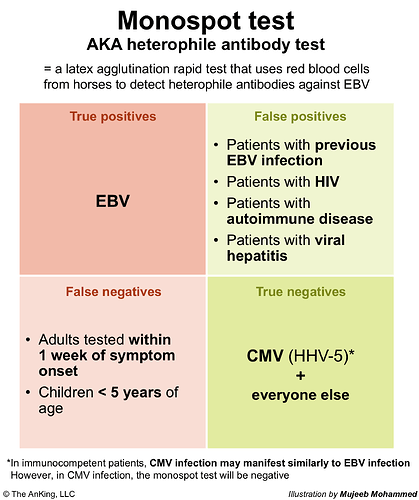 This image explains the Monospot test, highlighting true positives, false positives, false negatives, and true negatives for detecting heterophile antibodies against EBV. (Captioned by AI)