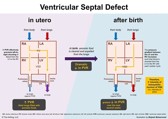 vsd