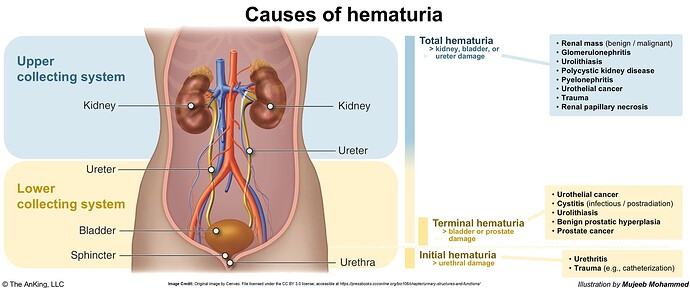 Causes of hematuria