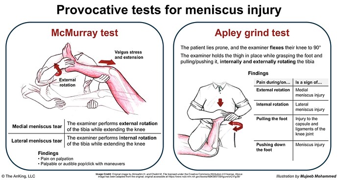 The image compares the McMurray and Apley grind tests used to diagnose meniscus injuries, detailing procedures and findings for each test. (Captioned by AI)
