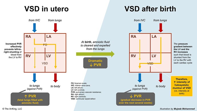 vsd