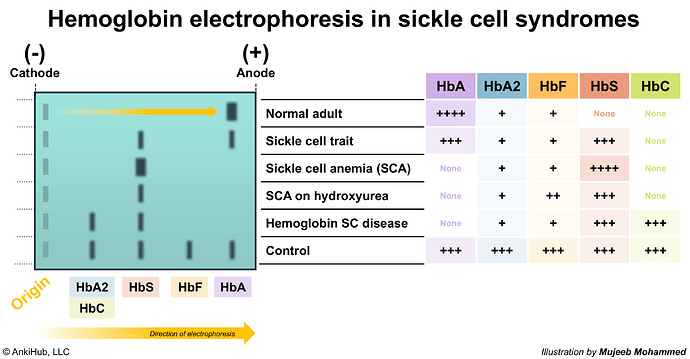 Hb electrophoresis in sickle cell