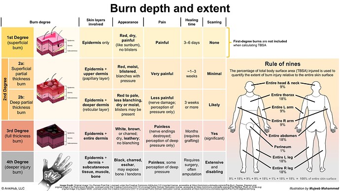 The image is a chart detailing burn depth and extent, including degrees of burns, affected skin layers, symptoms, healing time, and scarring, alongside a "Rule of Nines" diagram for estimating body surface area affected by burns. (Captioned by AI)