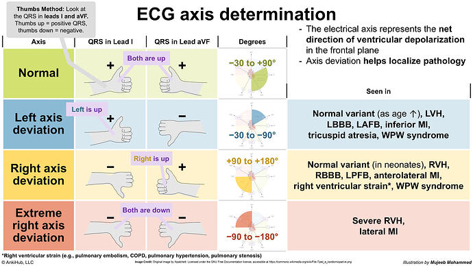 ECG Axis