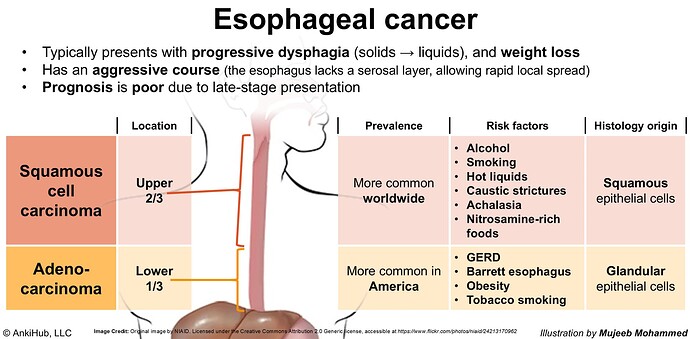Esophageal cancer