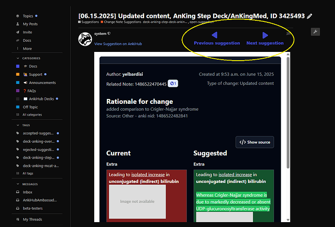 The image shows a suggestion for updating content on AnkiHub, with navigation buttons for previous and next suggestions, displaying a change related to Crigler-Najjar syndrome. (Captioned by AI)
