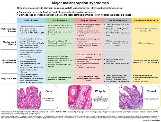 Major malabsorption syndromes