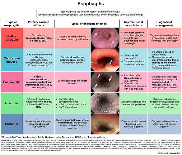 Types of esophagitis by Marcos Zan (1) copy