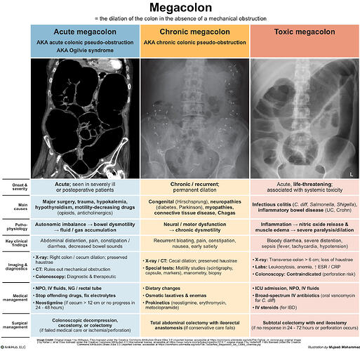 Megacolon