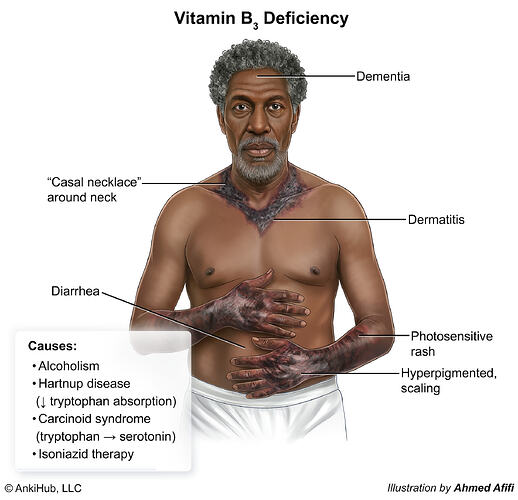 Vitamin B3 deficiency