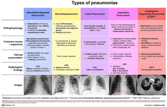 Types o pneumonia by Marcos Zan V2 2