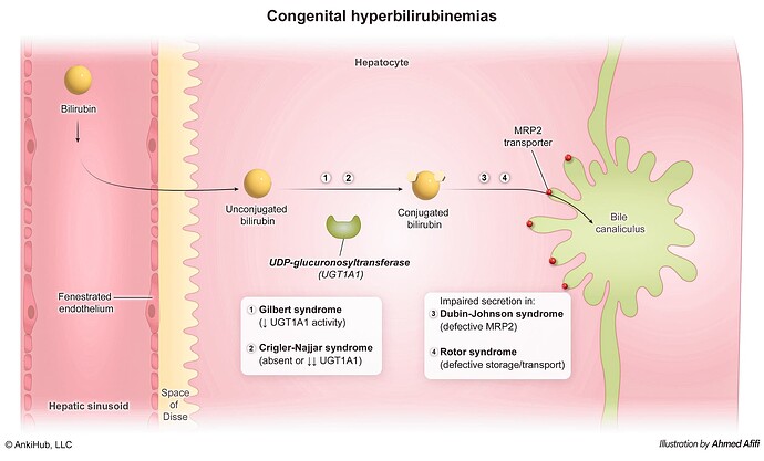 Congenital Hyperbilirubinemia  - comp