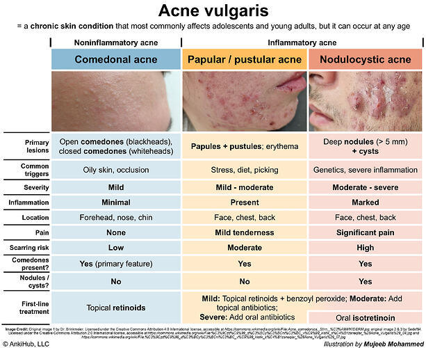 Acne vulgaris