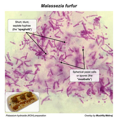 m furfur